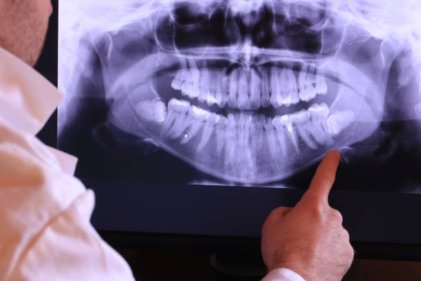 Best Emergency Broken Tooth Repair in Garden City, SC